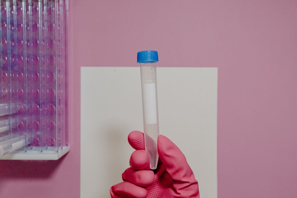 Où faire analyser son eau : laboratoire, pharmacie ou kit ?